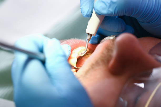 Best Weekend Emergency Dentist in Mantua, VA