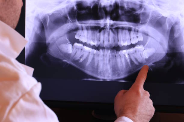 Best Pediatric Emergency Dentist in Mantua, VA