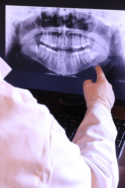 Best Emergency Dental Extractions in Mantua, VA
