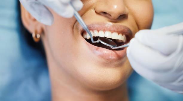 Best Emergency Root Canal Treatment in Mantua, VA