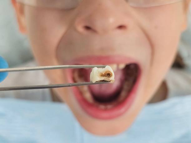 Best Mobile Emergency Dentist in Mantua, VA