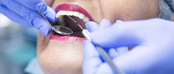 Best Emergency Dentist for Lost Fillings or Crowns in Mantua, VA